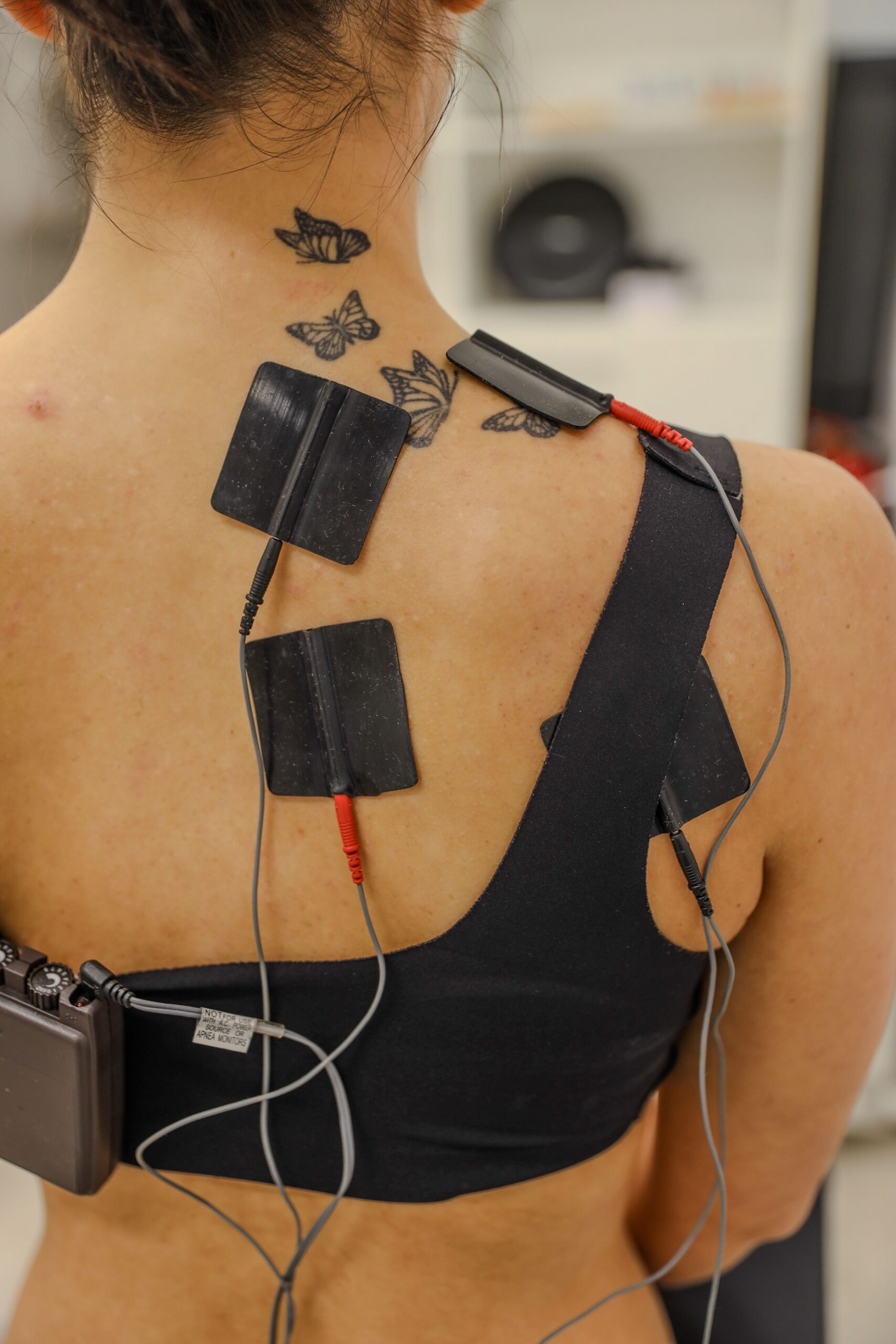 Elektroterapija Papillon Clinic Virovitica